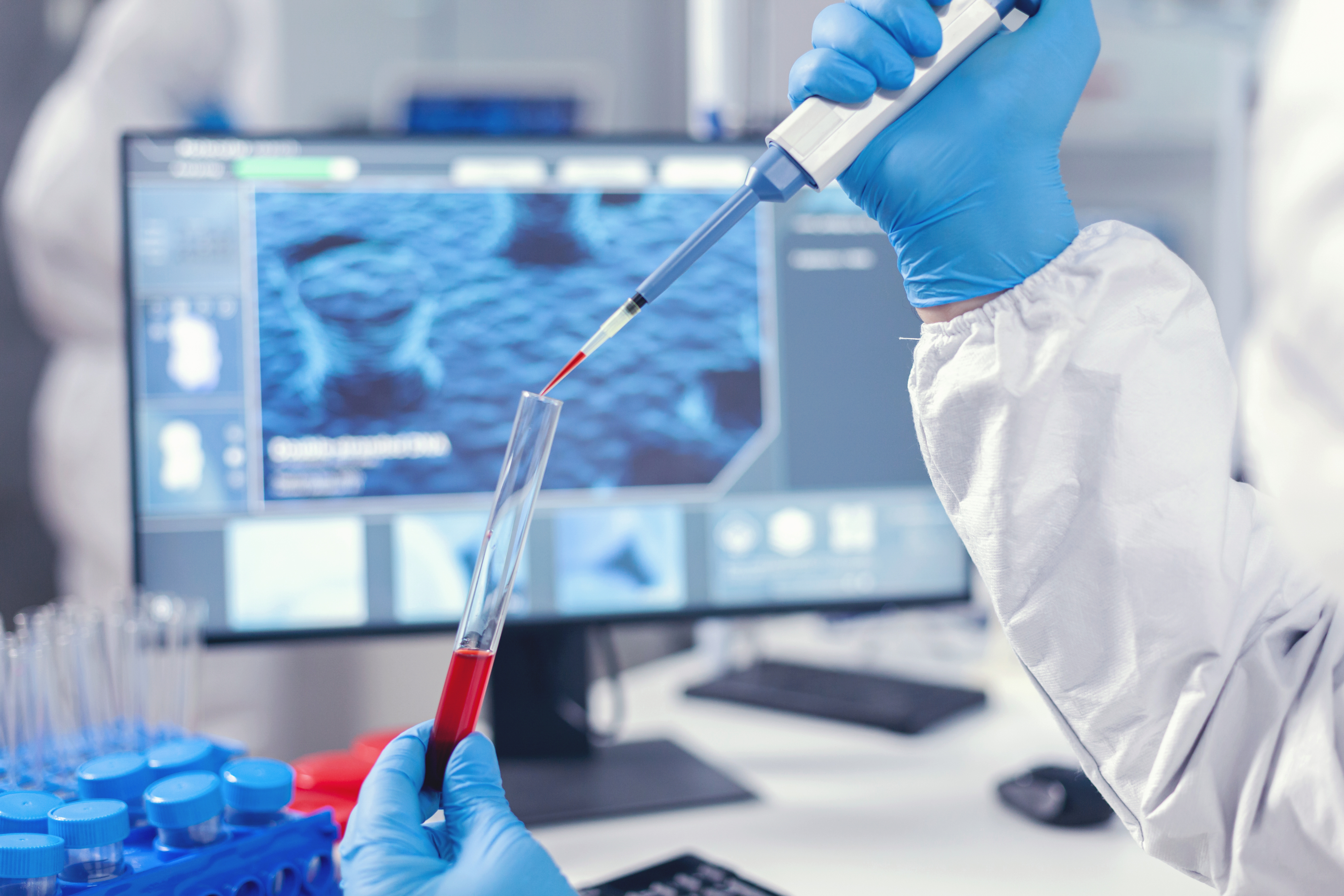 lab test